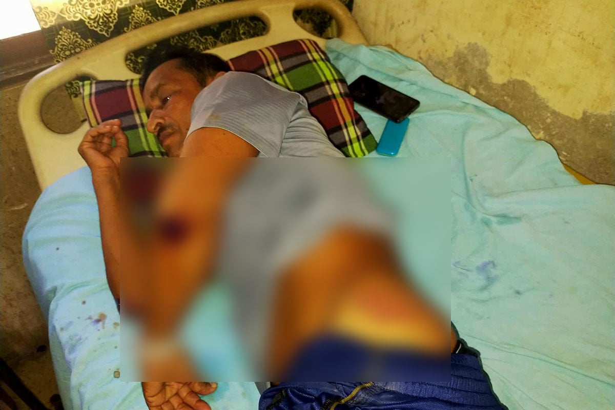 কুমারখালীতে বিএনপি নেতাকে হাতুড়িপেটা, কার্যালয় ভাঙচুরের অভিযোগ