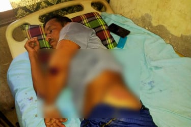 কুমারখালীতে বিএনপি নেতাকে হাতুড়িপেটা, কার্যালয় ভাঙচুরের অভিযোগ