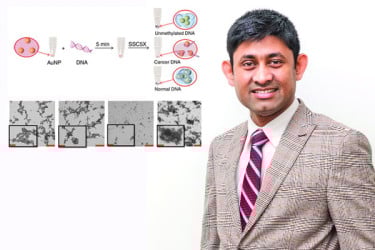 ১০ মিনিটেই হবে ক্যানসার শনাক্ত