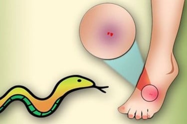 বোয়ালমারীতে সাপের কামড়ে গৃহবধূর মৃত্যু