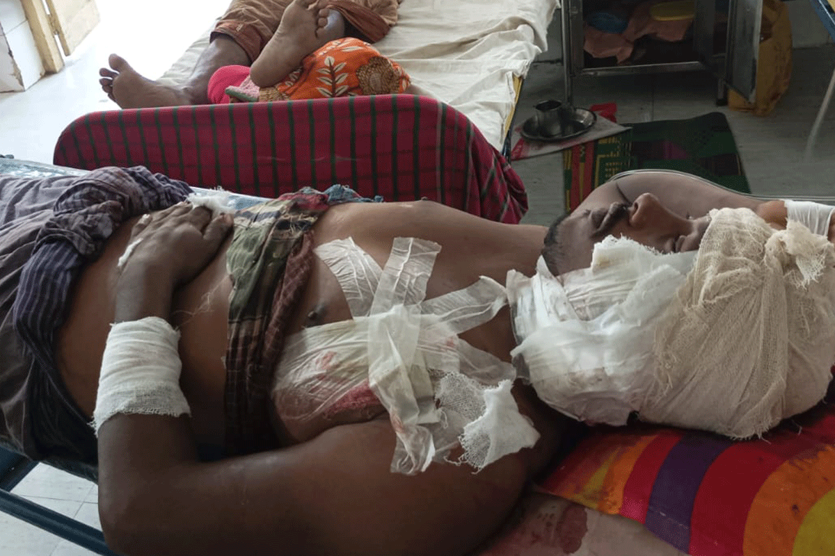 চুয়াডাঙ্গায় একই পরিবারের ৫ জনকে কুপিয়ে জখম