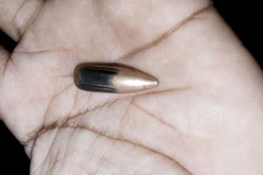 মিয়ানমার সীমান্তে গোলাগুলি, টেকনাফে নারী আহত