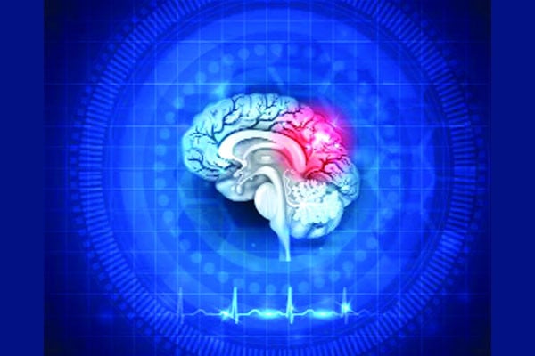 স্ট্রোকের চিকিৎসা ঢাকাকেন্দ্রিক