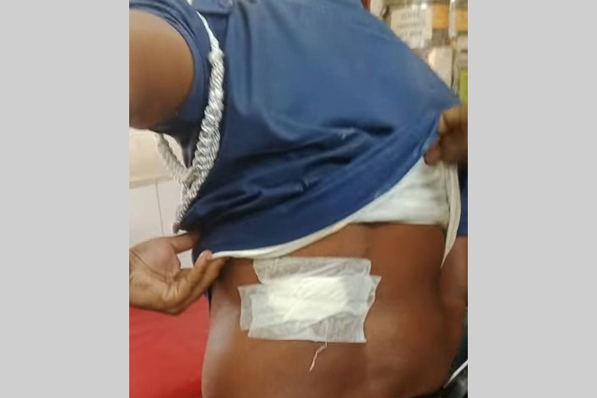 ফেনীতে পুলিশের ওপর হামলা, আহত ৩