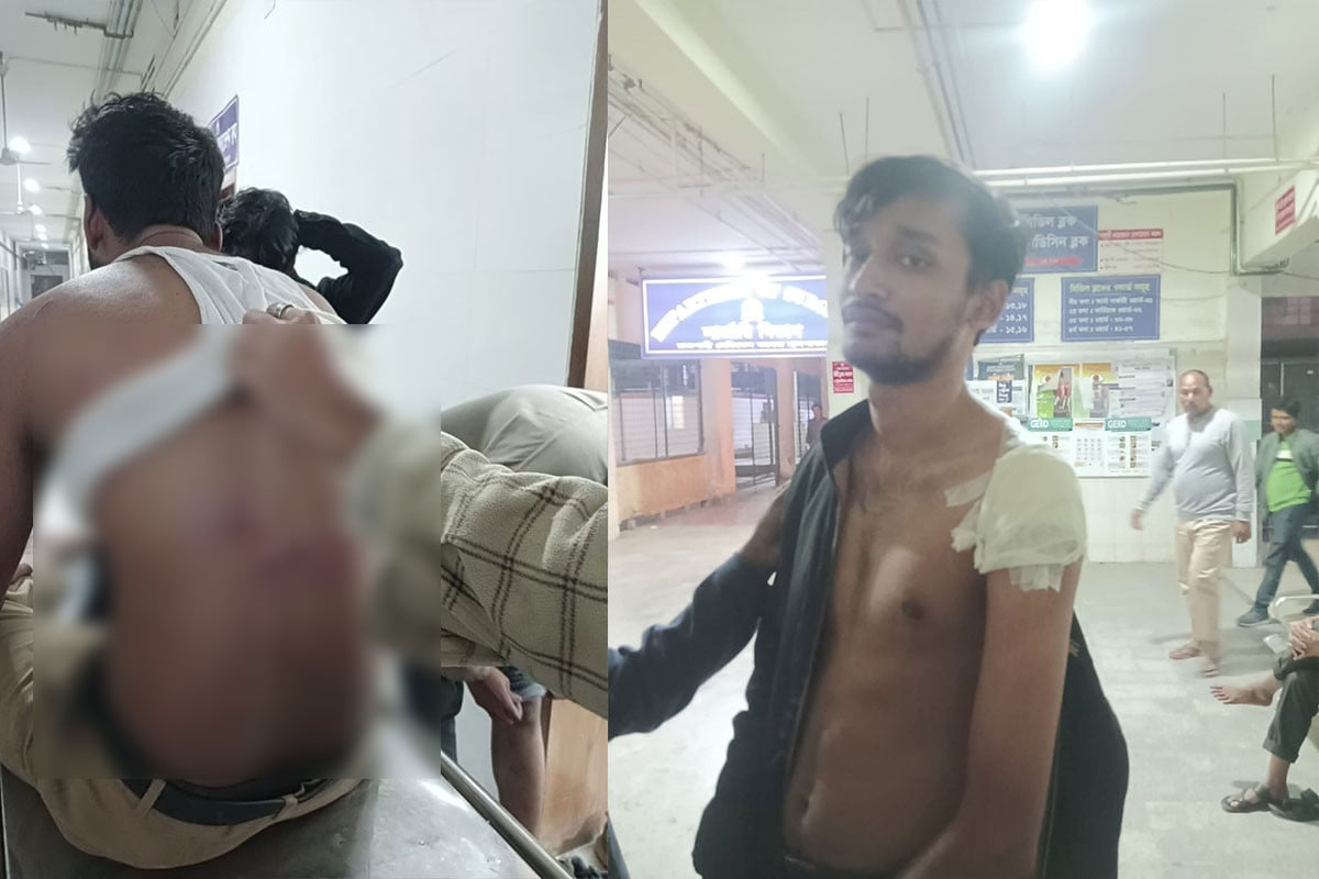 রাবিতে দুর্বৃত্তদের হামলায় তিন শিক্ষার্থী আহত