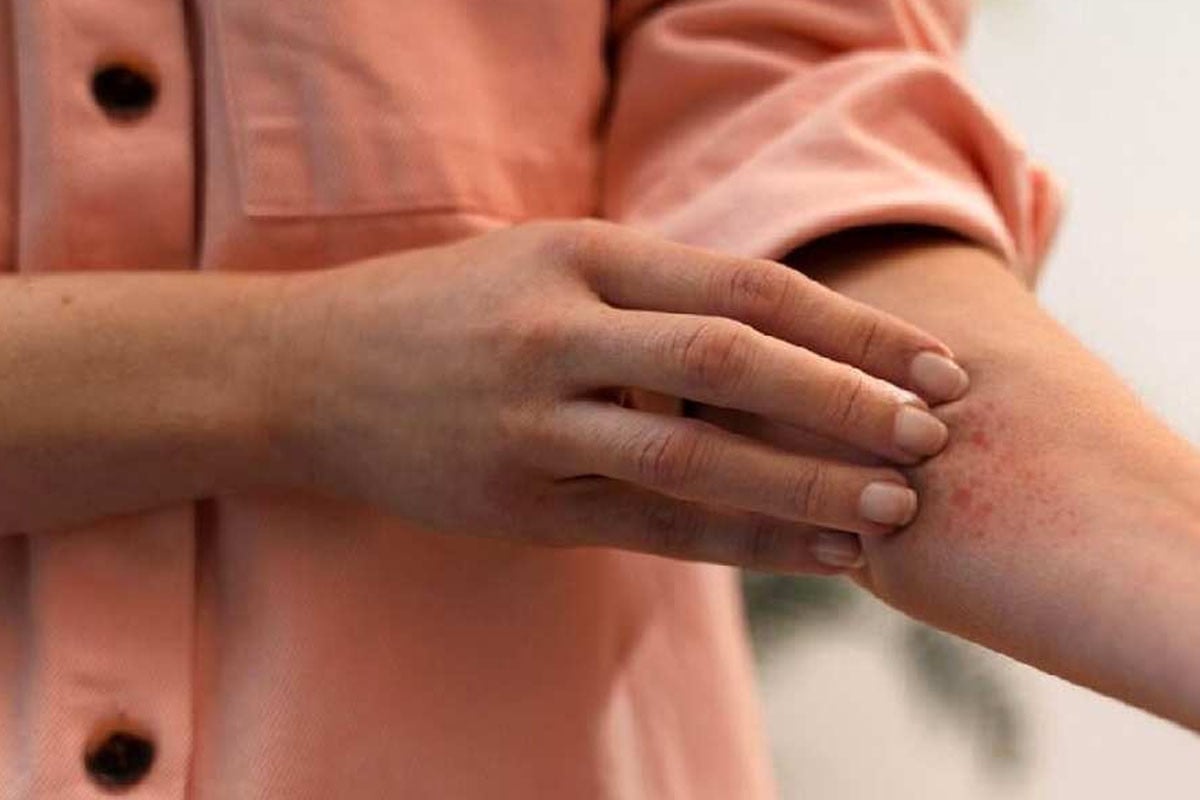 শীতে এলার্জির সমস্যা রোধে ৫ উপায়