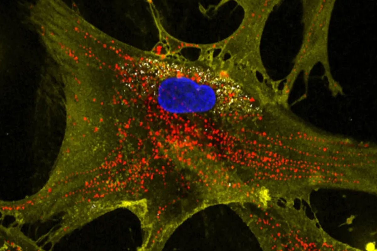 কোষের বার্ধক্য থামাতে ন্যানোফ্লাওয়ার প্রযুক্তি উদ্ভাবন