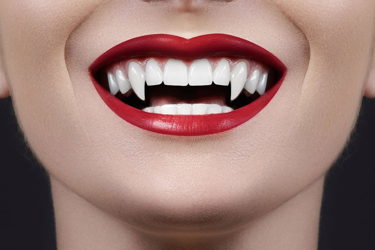 যে কারণে ভ্যাম্পায়ার দাঁতে আগ্রহ বাড়ছে তরুণীদের