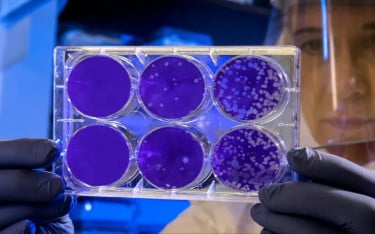 ‘মৃত্যুর ভান’ করে বেঁচে থাকা ব্যাকটেরিয়া নিয়ে নতুন সতর্কবার্তা