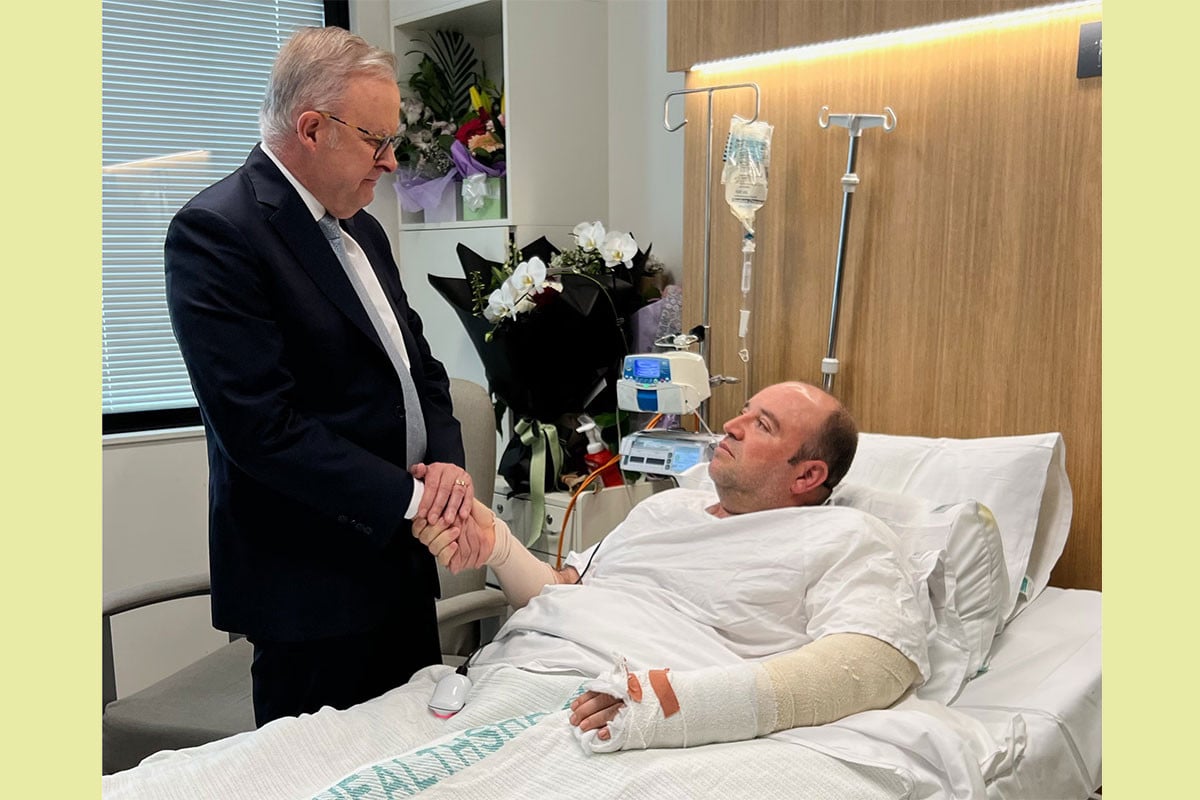 বন্ডি সৈকতের বীর আহমেদকে দেখতে হাসপাতালে অস্ট্রেলিয়ার প্রধানমন্ত্রী