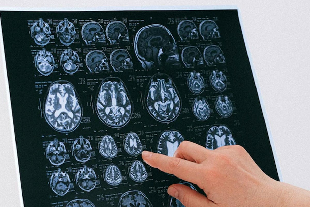 নেশা ও ওসিডি বোঝার নতুন পথ দেখাল ইঁদুরের ওপর গবেষণা