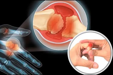 আঙুল ফোটালে ক্ষতি নয় বরং অন্য গল্প বলছে বিজ্ঞান