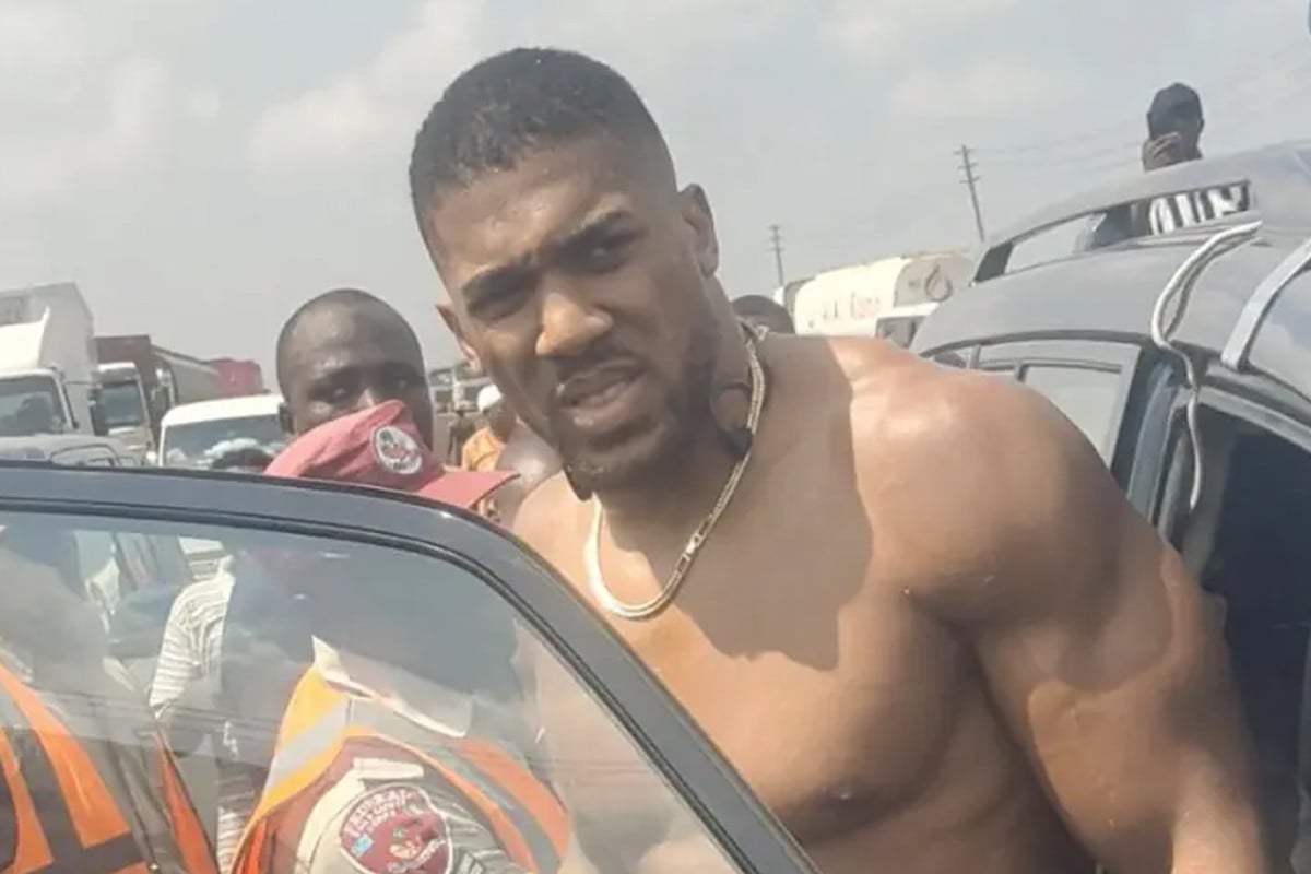 সড়ক দুর্ঘটনায় আহত বক্সিং চ্যাম্পিয়ন অ্যান্থনি জশুয়া