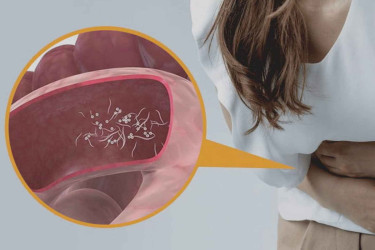 শরীরে কৃমি বাসা বেঁধেছে কি না বুঝবেন যে ৫ লক্ষণে