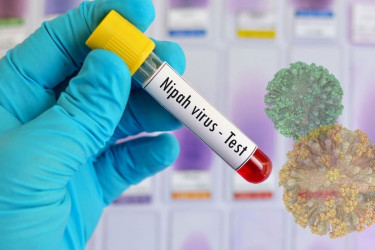 ভারতে নিপাহ ভাইরাসের সংক্রমণ, পাকিস্তানে সতর্কতা জারি