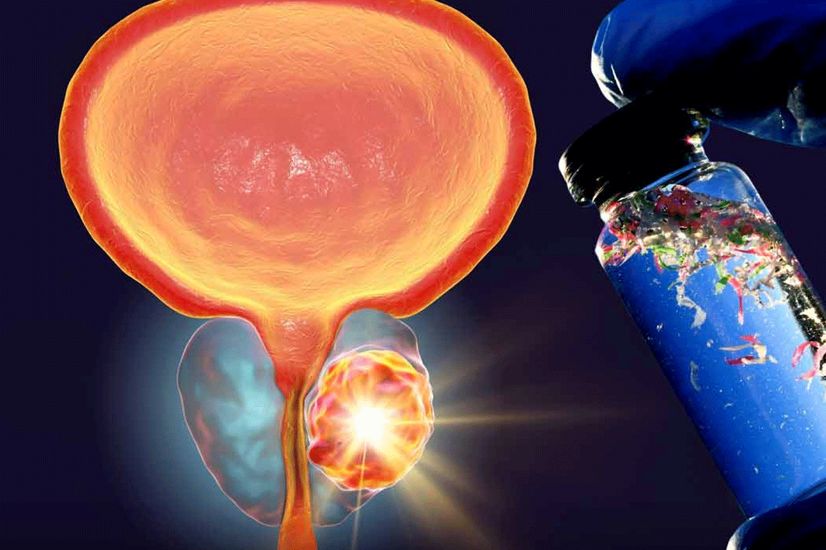 মানবদেহে প্লাস্টিককণা জমে গজাচ্ছে টিউমার!