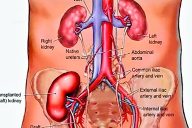 তুরস্কে ফাঁদ কিডনি প্রতিস্থাপনের