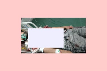 শহীদ মিনারে গুলিবিদ্ধ কনটেন্ট ক্রিয়েটর রাকিবের মৃত্যু