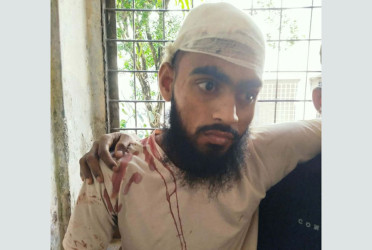 নরসিংদীতে মাদকের বিরুদ্ধে প্রতিবাদ করায় ইমামকে কুপিয়ে জখম