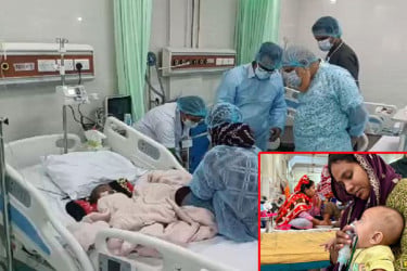 সিলেটে হাম আক্রান্ত হয়ে প্রথম মৃত্যু, হাসপাতালে ভর্তি শতাধিক