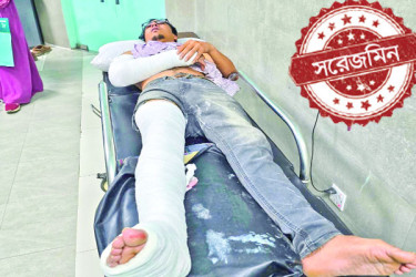 সেবার আড়ালে সরঞ্জাম বাণিজ্য
