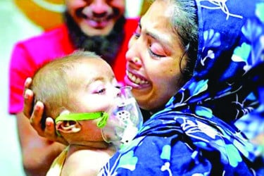 হামের উপসর্গ নিয়ে দিনে ভর্তি হচ্ছে ৫৫ শিশু