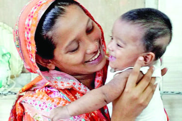 হামের উপসর্গে মৃত্যু আরও সাত শিশুর