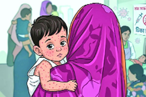 হামের উপসর্গে আরও পাঁচ শিশুর মৃত্যু