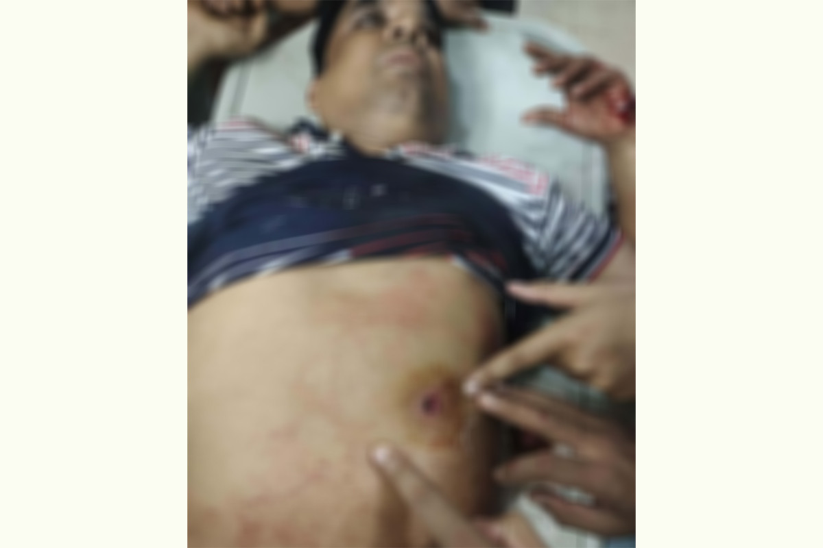 নোয়াখালীতে বিএনপি নেতাকে লক্ষ্য করে গুলি, সহযোগীর বুকে বিদ্ধ