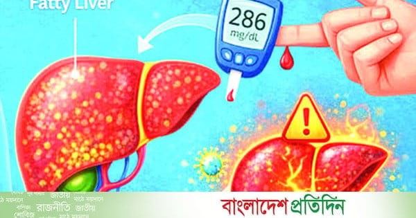 ফ্যাটি লিভার ও ডায়াবেটিসের অদৃশ্য যোগসূত্র